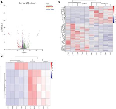 Identifying key m6A-methylated lncRNAs and genes associated with neural tube defects via integrative MeRIP and RNA sequencing analyses